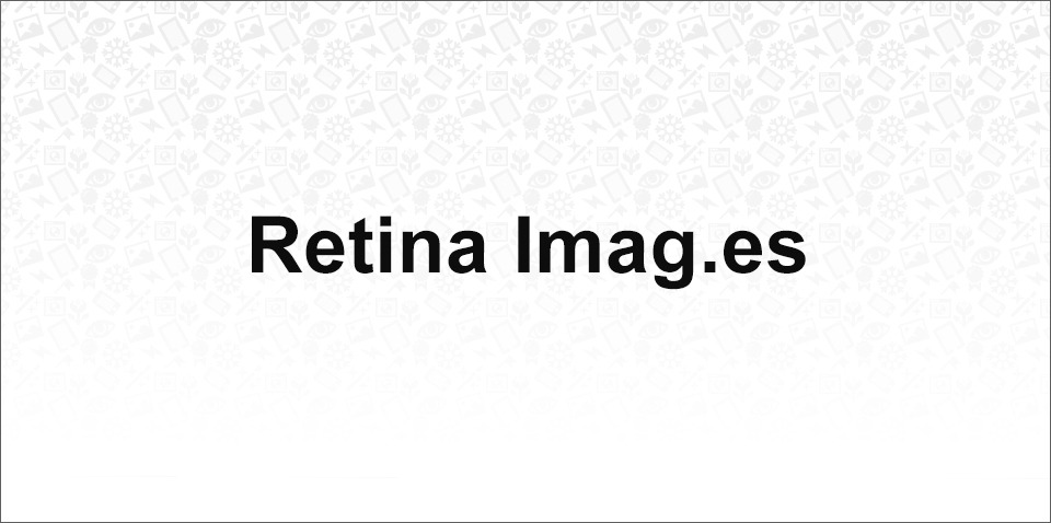 Retina Images – Automatically serve high-res images, to those who’ll appreciate them.